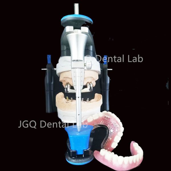High Precision Pure Titanium Implant Bar CNC Cutting for Dental Restorations