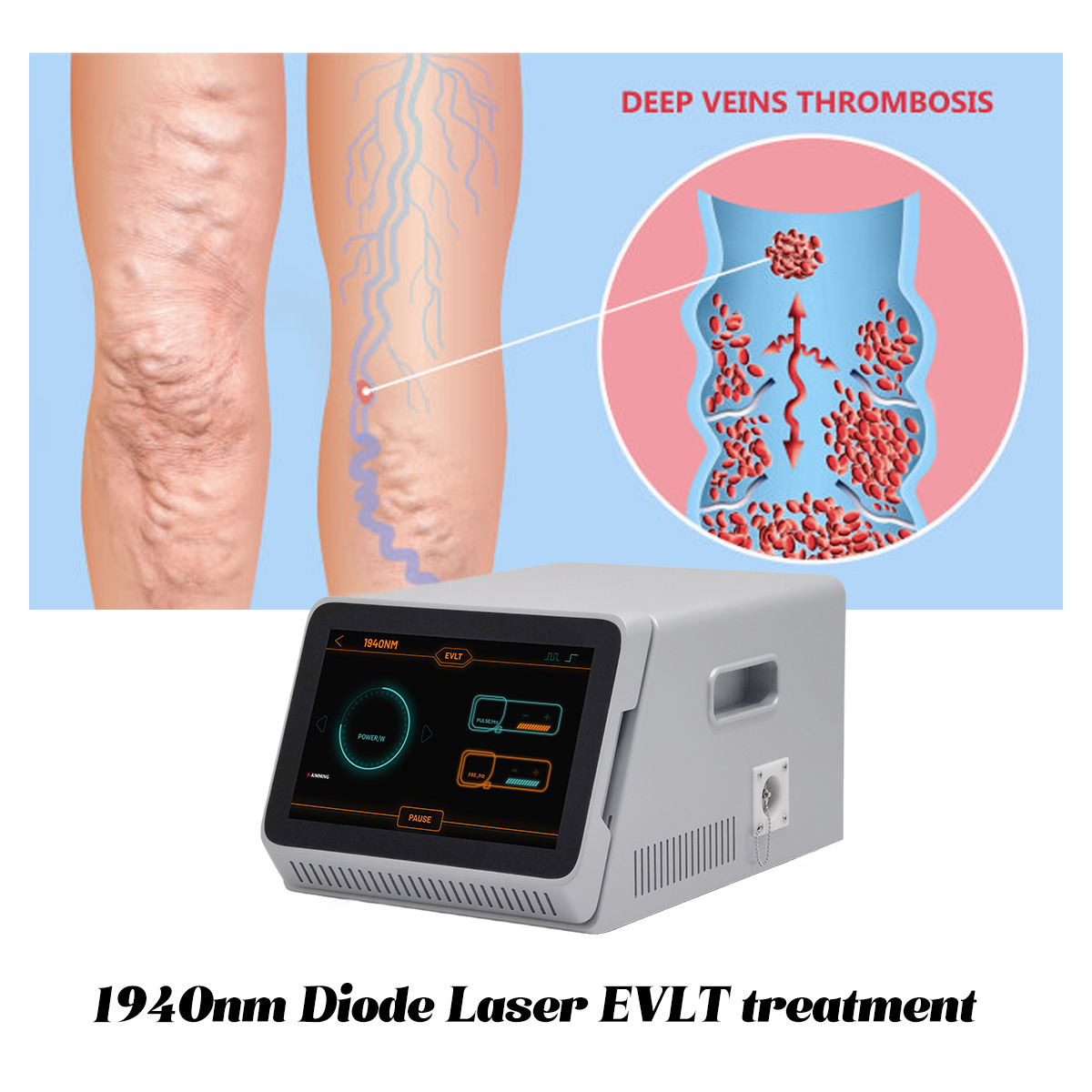 Leg Varicose Veins Laser Treatment EVLT  1940NM Diode Laser Machine