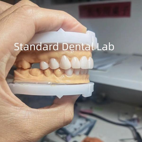 Perfect Esthetics Provisional Wax Up for Dental Professionals using dental wax from China Dental Lab