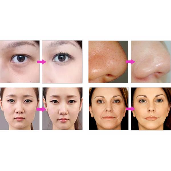 7 in 1 Galvanic Microcurrent Facial Machine Diamond Microdermabrasion Electroporation Mesotherapy Emssings Face Lift Machine