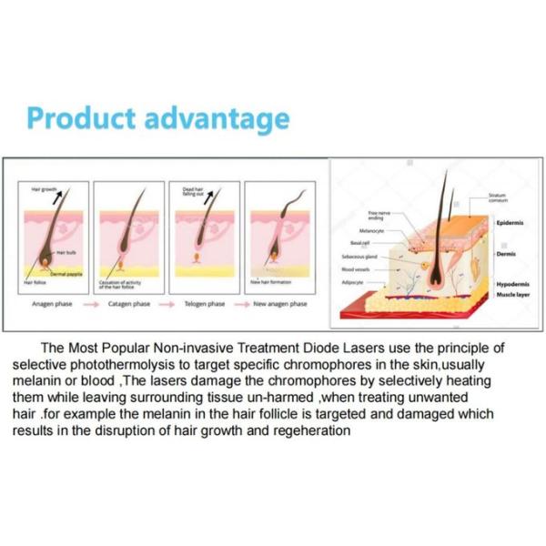 2024 Latest Model Diode Laser 1800 Watt 808 Diode Laser Hair Removal Machine 3 Wave Diode Laser Hair Removal