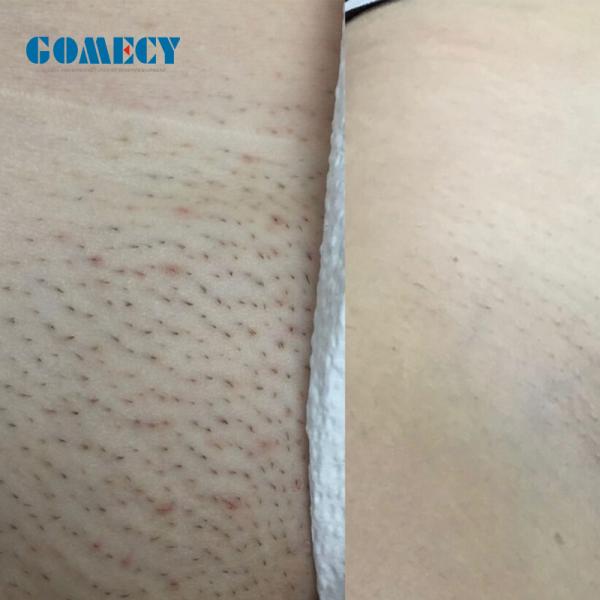 Лазерная машина с белыми диодами 4 длины волны лазерная эпиляция для салона