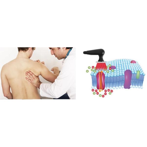 Monopolar CET RF ВЫМАЧИВАТЬ кожу затягивая машину красоты