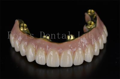 Professional Efficient Treatment All On 6 Implants For Dental Issues