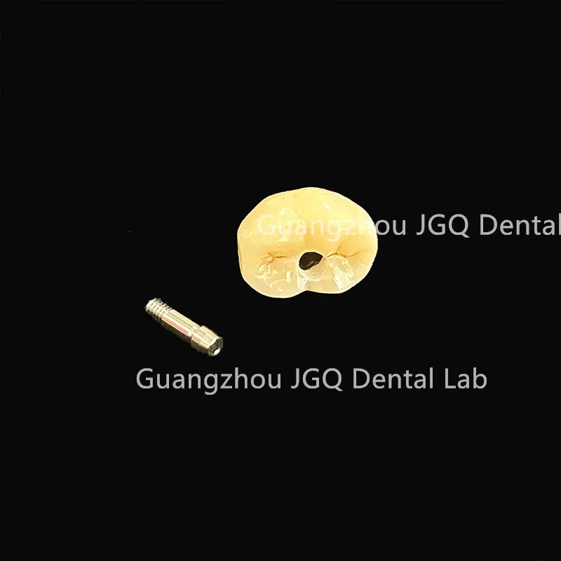 Dental Lab Durability Implants Make Cost-Effective Option in The Long Run