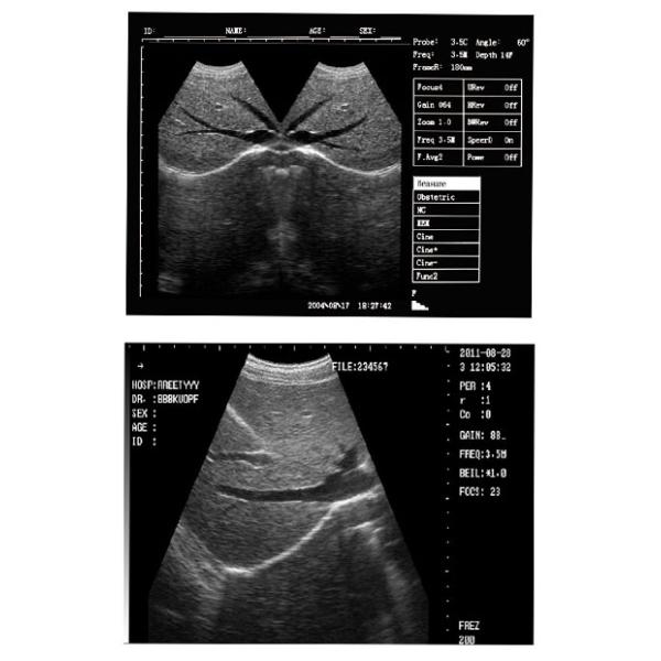 Human Use 12 Inch Laptop black and white ultrasound machine with 2 Probe Connector