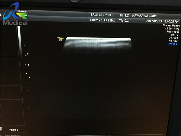 SP10-16-D a utilisé machine linéaire de radiographie de sonde d'ultrason la 2D