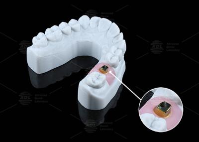 Implantes e soluções dentárias à base de titânio resistentes à corrosão personalizadas