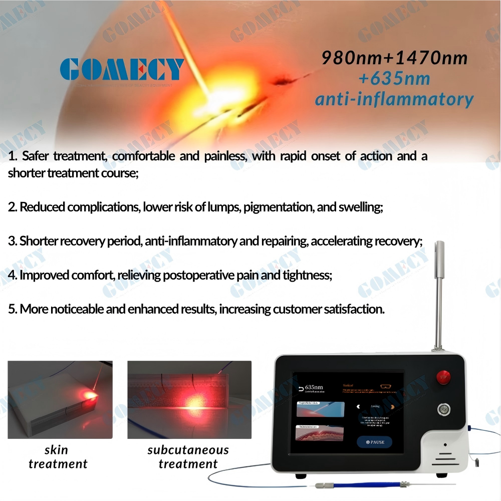 Newest Diode Laser 980nm 1470nm Liposuction Lipolysis Body Slimming Endolaser Facial Skin Lifting