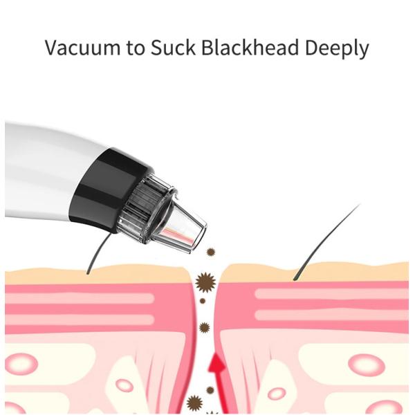 3 Hours Charge ABS USB Vacuum Blackhead Remover
