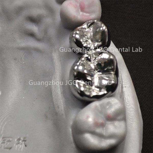 China Dental Lab Full Metal Crown and Bridge Dentures Metallic Lustre