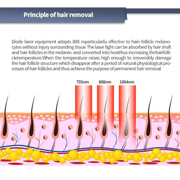 1200w/1600w Triple Wavelength Diode Laser Hair Removal Beauty Machine 755nm 808nm 1064nm