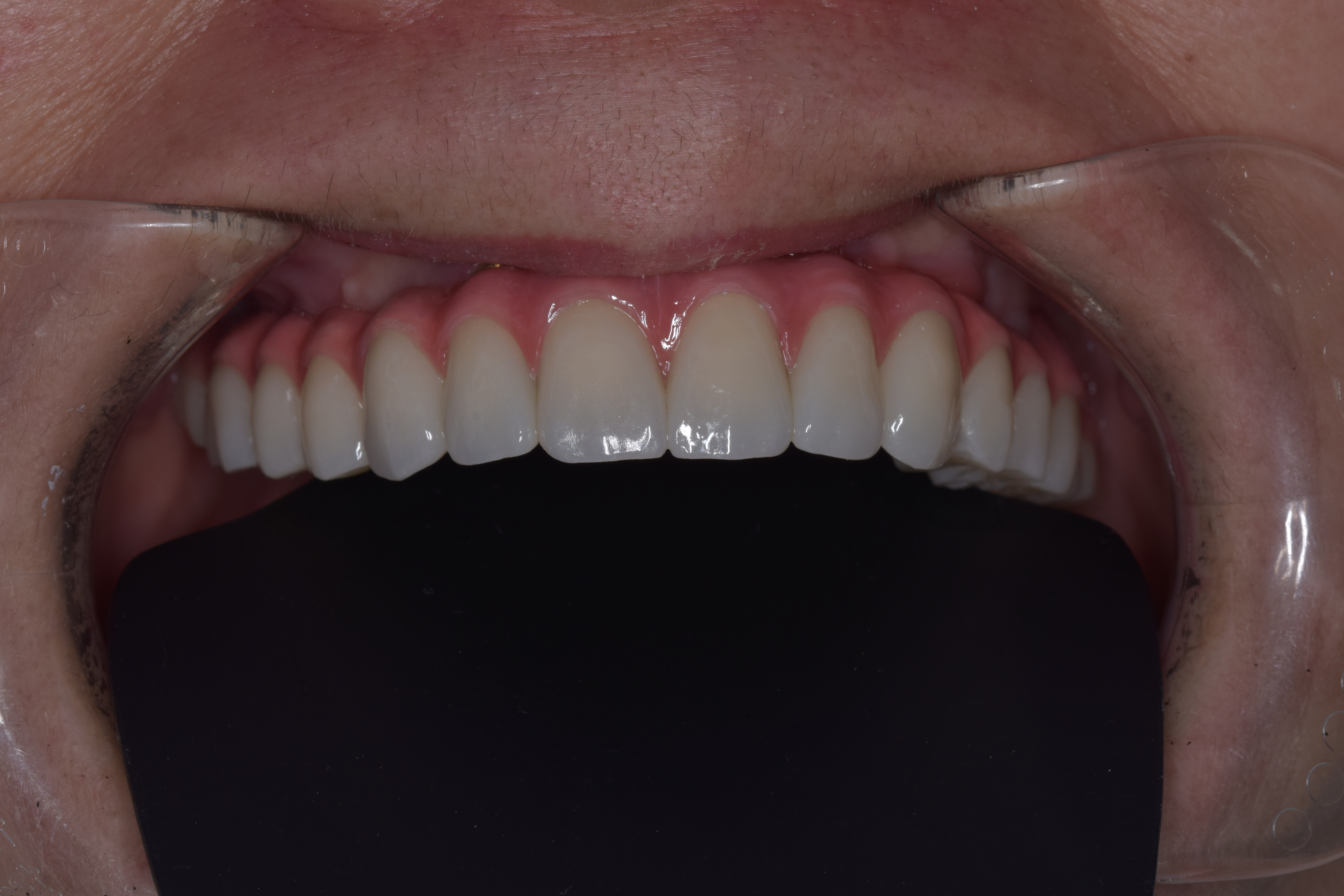 Pro разнослоистый блок Zirconia 1050Mpa зубоврачебный 3d для зубов облицовок