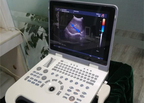 Панорамная фокусируя машина Допплер цвета с функцией 4Д опционной