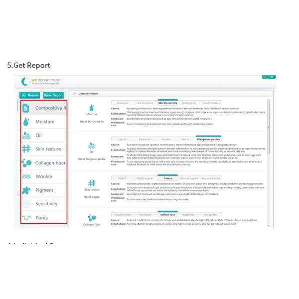 машина 2560 * 1920 анализа кожи анализатора объема кожи разрешения для спа красоты
