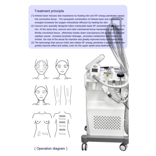 Best rf vacuum cavitation machine / vela vacuum roller body shape slimming machine LF-162