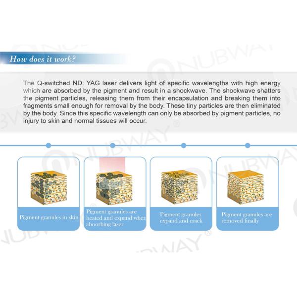 Professional 1064nm 532nm q switched nd yag laser/Laser tattoo removal machine