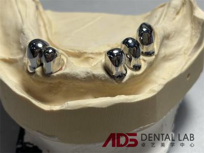 Telescopic Precision Attachment Partial Full Dentures Crown Prosthesis OEM