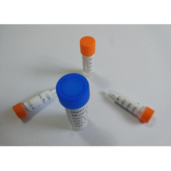 Подгонянные анти--ЭДДП антитела мыши/крысы моноклональные для исследования Витро