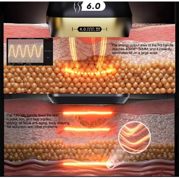 Портативный 2 в 1 13d Max Dual System Hifu Machine для антивозрастного увлажнения детей