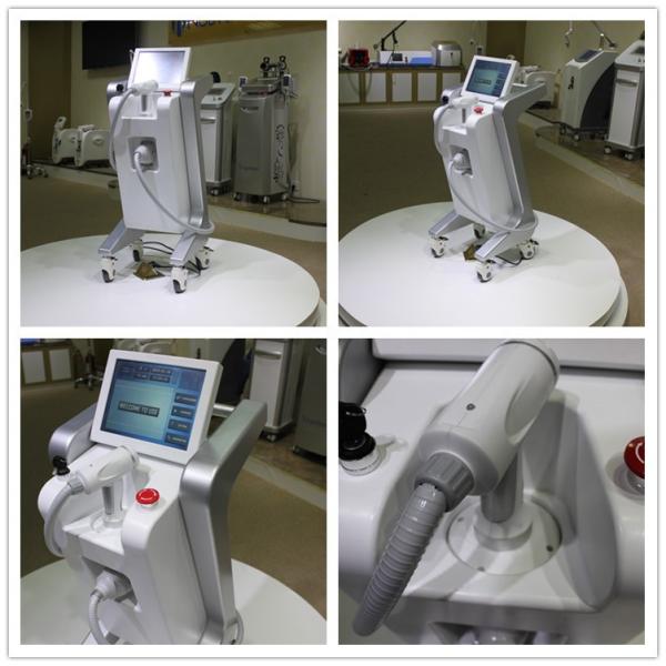 hifu korea!!!! HIFU / hifu machine / high intensity focused ultrasound hifu machine