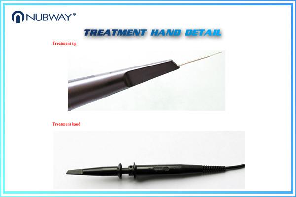 30MHz Blood Vessels Removal Equipment portable spider vein removal machine
