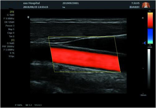 Оборудование ультразвука блока развертки 4д ультразвука медицинской машины ультразвука портативное