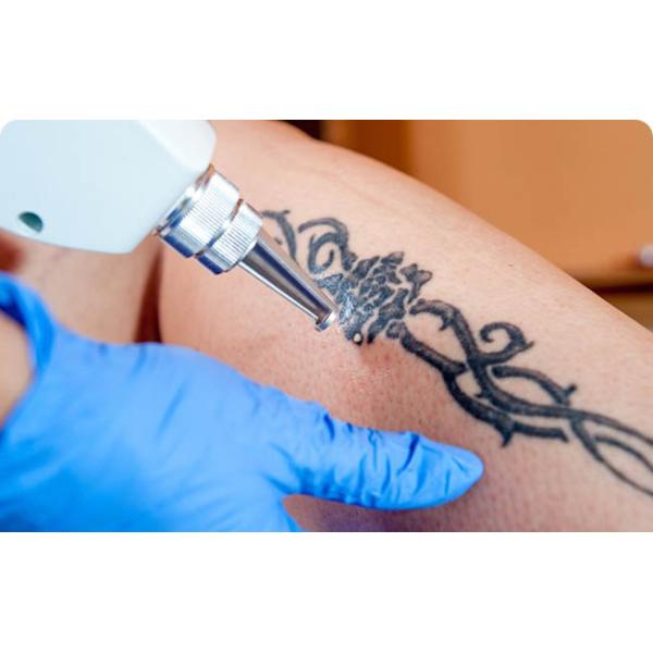 800w ND YAG Laser Tattoo Removal Machine , Freckle Birth Mark Removal Laser Yag Machine