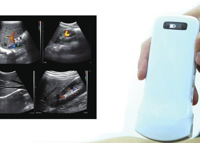 Цвет Doppler мини Handheld блока развертки ультразвука портативный с многочастотными элементами 2-10MHz 128 64 канала