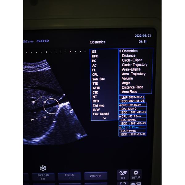 Hospital Outside Diagnostic Linear Ultrasound Machine Dog Ultrasound Machine Laptop Cow Pregnancy Sheep Scanner