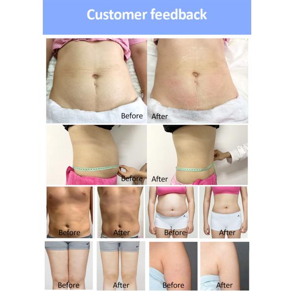 Dispositivo de escultura corporal no invasivo sin dolor Equipo de belleza láser de 635nm