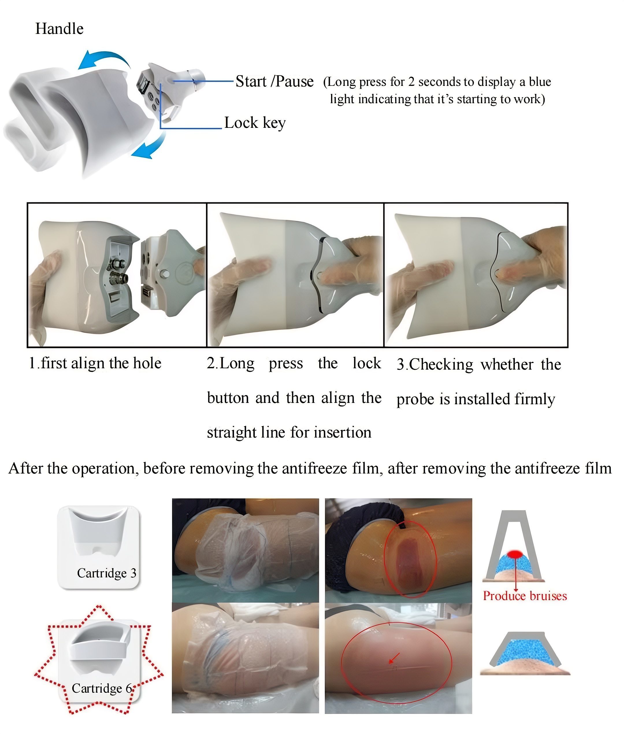 360° Cryolipolysis Machine | Professional Fat Freezing