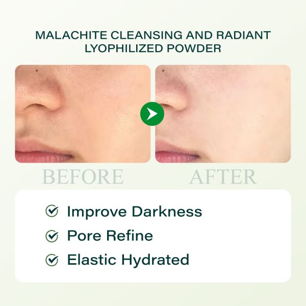 OEM Factory Professional Acne Repair and Skin Whitening Facial Serum Set Hyaluronic Acid Day Night Home Use for Salon Beauty