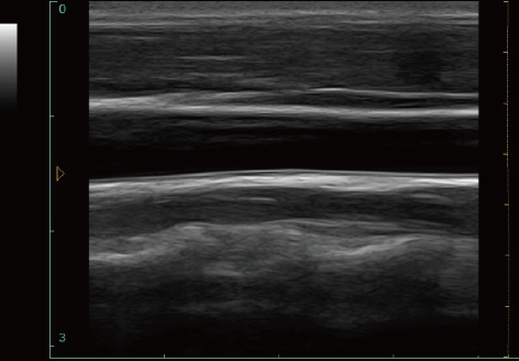 Блок развертки ультразвука ноутбука ультразвука СИД 12 дюймов диагностический медицинский с одним зондом подключает программное обеспечение ветеринара доступное