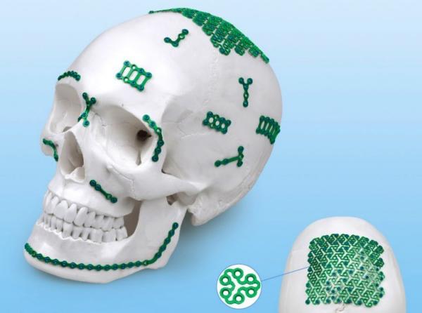 HA do tipo Maxillofacial placas ortopédicas do implante YM de 2.0mm do osso