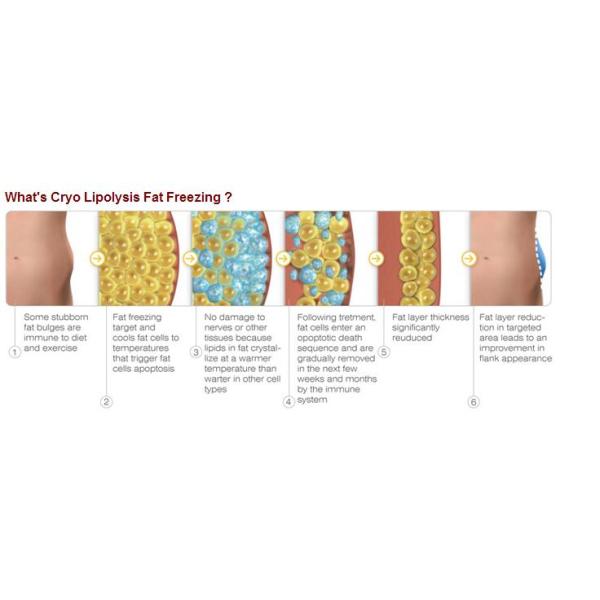 Professional 4 Hand Pieces Cryolipolysis Fat Freeze Slimming Machine