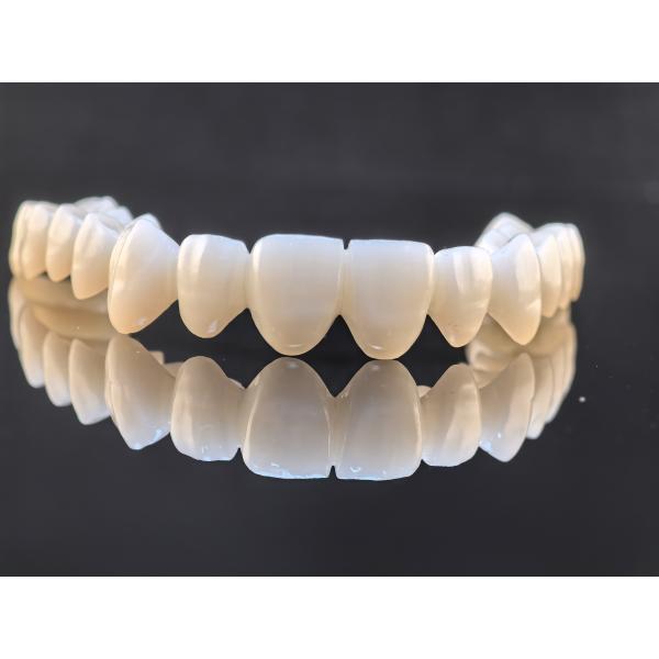 High Translucency Full Contour Zirconia Bridge