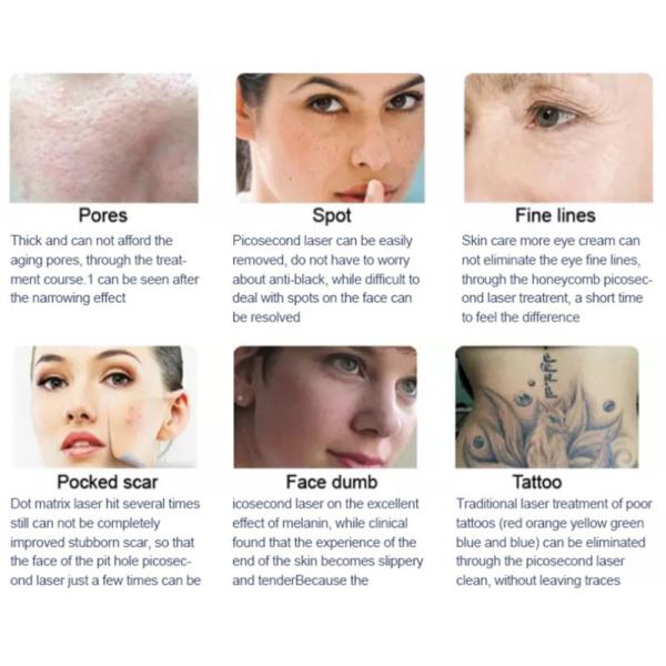 Мультифункциональная 3 в 1 808nm диодная лазерная эпиляция эпиляция татуировки