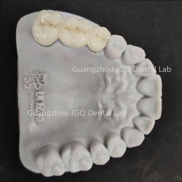 Zirconia Crown Bridge Dental Laboratory China High Accuracy CE FDA ISO Standard