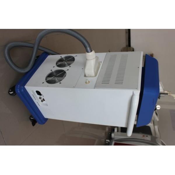 tatoo removal nd yag laser,portable q switched nd yag laser beauty machine price