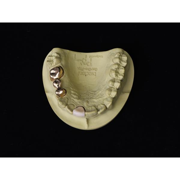 Audental 90 Restauración dental Alta aleación noble, aleación de cerámica dental amarillo Au89.5%