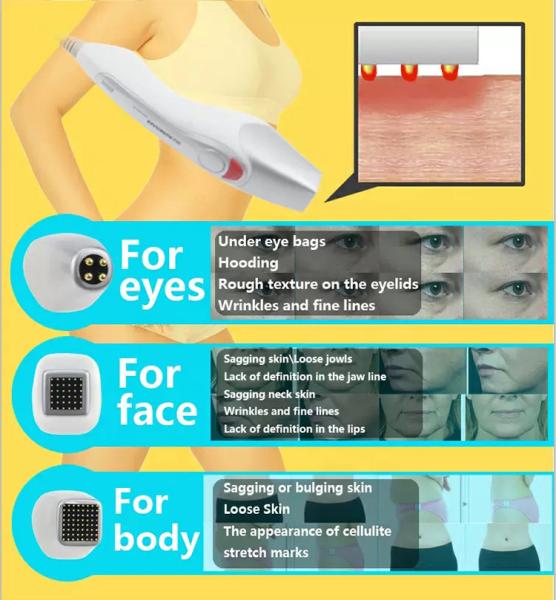 Enruga a pele da remoção que aperta a máquina fracionária do Rf Microneedle