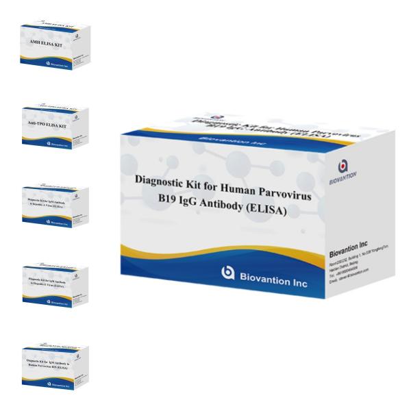 Diagnostic Kit For Human Parvovirus B19 IgM Antibody Elisa Test Kit With 96T