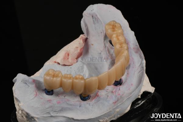 High Precision Full Contour Zirconia High Stain Resistance For Dental Applications