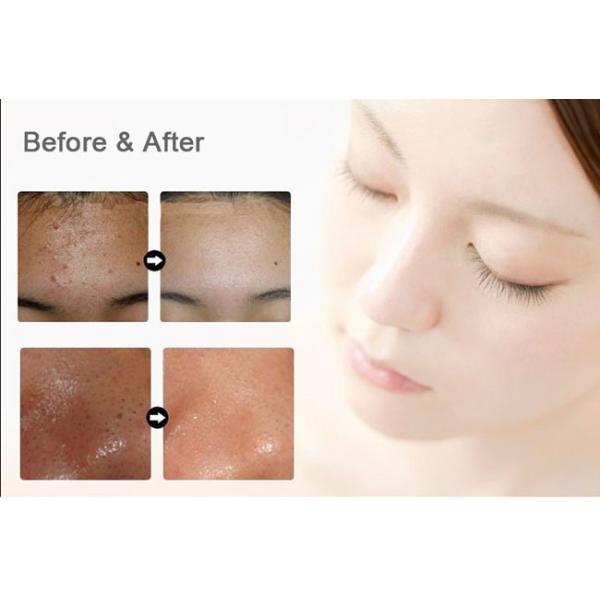 7 Colors Light Photodynamic Therapy Machine ,  Anti - Aging LED Photofacial Machine