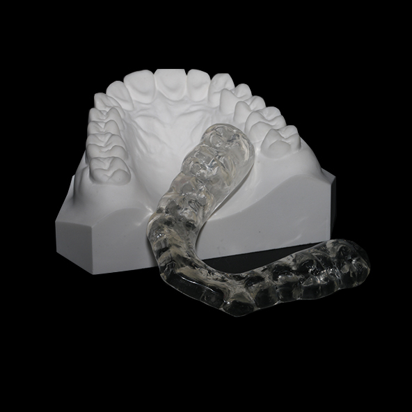 Digital Dental Solutions Lab | Dental Hard Occlusal Splint 1-3mm For Jaw Pain Relief Protection Oral