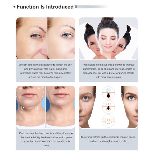 5 удаление пигмента Nd Yag 1064nm машины 4D 2940nm лазера СО2 ручки частичное