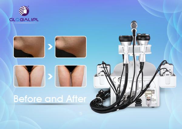 Skin Lifting Laser Ultrasonic Cavitation Machine , Slimming Beauty Machine 38*60*70cm