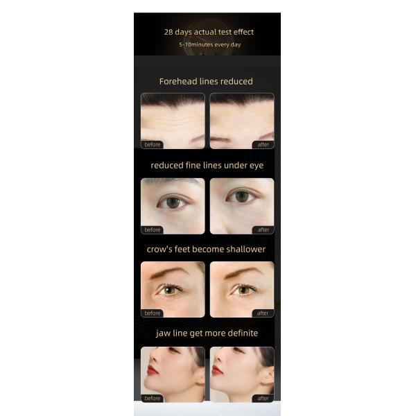 Multifunction Beauty Machine RF Anti Wrinkle Portable Beauty Equipment Vibration Face Massage Lifting Machine