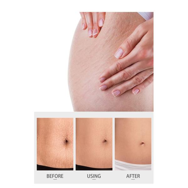 Línea de cuidado de la piel para el embarazo natural Aceite de masaje calmante con aceite de semilla de cacao OEM